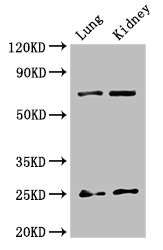 HMG1 / HMGB1 Antibody - Positive WB detected in:Mouse lung tissue,Mouse kidney tissue;All lanes:HMGB1 antibody at 2.7ug/ml;Secondary;Goat polyclonal to rabbit IgG at 1/50000 dilution;Predicted band size: 25 kDa;Observed band size: 25,70 kDa;