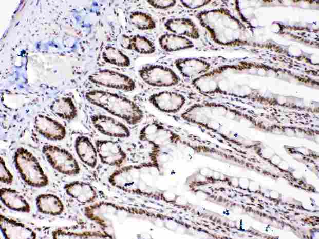 HMG1 / HMGB1 Antibody - HMGB1 was detected in paraffin-embedded sections of rat intestine tissues using rabbit anti- HMGB1 Antigen Affinity purified polyclonal antibody