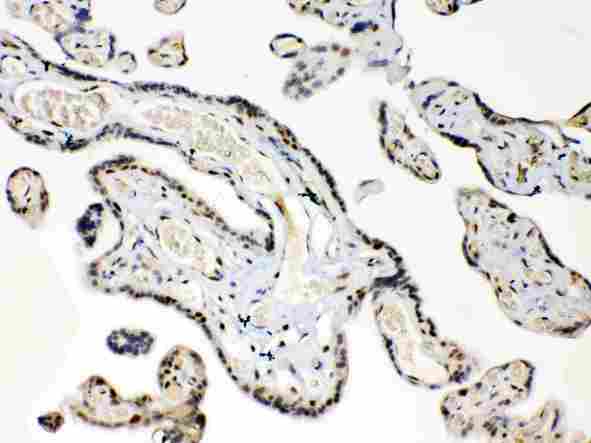 HMG1 / HMGB1 Antibody - HMGB1 was detected in paraffin-embedded sections of human placenta tissues using rabbit anti- HMGB1 Antigen Affinity purified polyclonal antibody