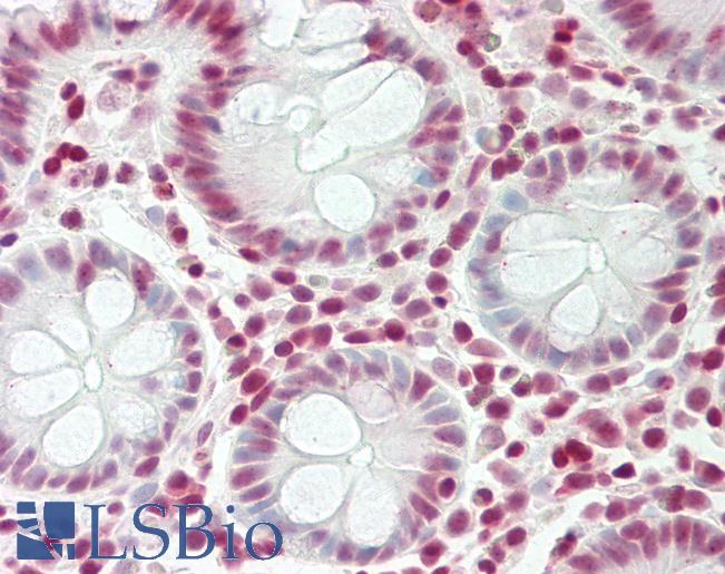 HMG1 / HMGB1 Antibody - Human Colon: Formalin-Fixed, Paraffin-Embedded (FFPE).  This image was taken for the unconjugated form of this product. Other forms have not been tested.