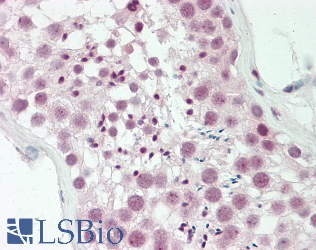 HMG1 / HMGB1 Antibody - Human Testis: Formalin-Fixed, Paraffin-Embedded (FFPE).  This image was taken for the unconjugated form of this product. Other forms have not been tested.