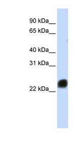 HMG1 / HMGB1 Antibody - HMGB1 antibody Western blot of HeLa lysate. This image was taken for the unconjugated form of this product. Other forms have not been tested.