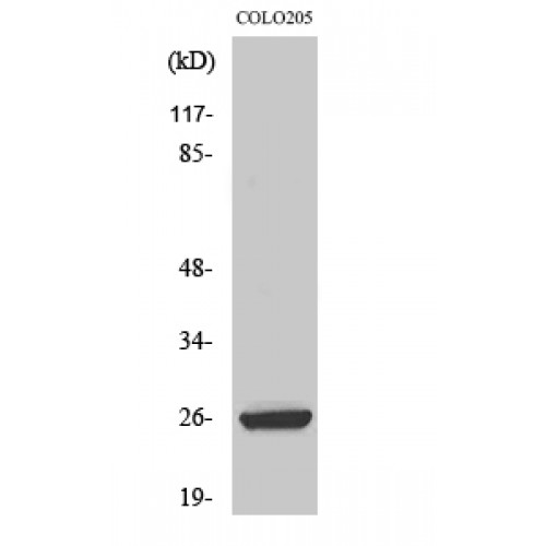 HMG2 / HMGB2 Antibody - Western blot of HMG-2 antibody