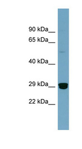 HMG2 / HMGB2 Antibody - HMGB2 antibody western blot of COLO205 cell lysate.  This image was taken for the unconjugated form of this product. Other forms have not been tested.