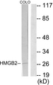 HMG2 / HMGB2 Antibody - Western blot analysis of lysates from COLO205 cells, using HMGB2 Antibody. The lane on the right is blocked with the synthesized peptide.