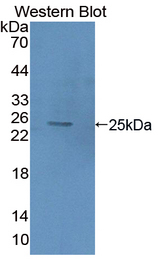 HMG2 / HMGB2 Antibody - Western blot of HMG2 / HMGB2 antibody.