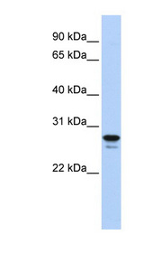 HMG2 / HMGB2 Antibody - HMGB2 antibody Western blot of Jurkat lysate. This image was taken for the unconjugated form of this product. Other forms have not been tested.