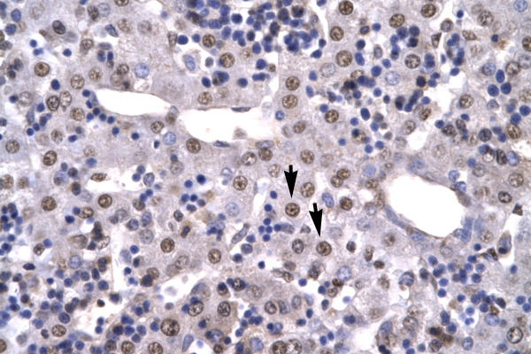 HMG2 / HMGB2 Antibody - HMGB2 antibody ARP31939_P050-NP_002120-HMGB2 (high-mobility group box 2) Antibody IHC of formalin-fixed, paraffin-embedded human Liver. Positive label: Hepatocytes indicated with arrows. Antibody concentration 4-8 ug/ml. Magnification 400X.  This image was taken for the unconjugated form of this product. Other forms have not been tested.
