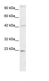 HMG2 / HMGB2 Antibody - Jurkat Cell Lysate.  This image was taken for the unconjugated form of this product. Other forms have not been tested.