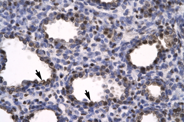 HMG2 / HMGB2 Antibody - HMGB2 antibody ARP31939_P050-NP_002120-HMGB2 (high-mobility group box 2) Antibody IHC of formalin-fixed, paraffin-embedded human Lung. Positive label: Alveolar Cells indicated with arrows. Antibody concentration 4-8 ug/ml. Magnification 400X.  This image was taken for the unconjugated form of this product. Other forms have not been tested.