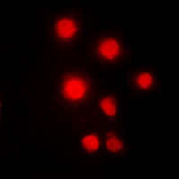 HMG2 / HMGB2 Antibody - Immunofluorescent analysis of HMGB2 staining in HeLa cells. Formalin-fixed cells were permeabilized with 0.1% Triton X-100 in TBS for 5-10 minutes and blocked with 3% BSA-PBS for 30 minutes at room temperature. Cells were probed with the primary antibody in 3% BSA-PBS and incubated overnight at 4 deg C in a humidified chamber. Cells were washed with PBST and incubated with a DyLight 594-conjugated secondary antibody (red) in PBS at room temperature in the dark. DAPI was used to stain the cell nuclei (blue).