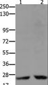 HMG2 / HMGB2 Antibody - Western blot analysis of HeLa and 231 cell, using HMGB2 Polyclonal Antibody at dilution of 1:2000.
