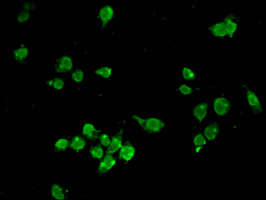 HMG2 / HMGB2 Antibody - Immunofluorescent analysis of SH-SY5Y cells using HMGB2 Antibody at a dilution of 1:100 and Alexa Fluor 488-congugated AffiniPure Goat Anti-Rabbit IgG(H+L)