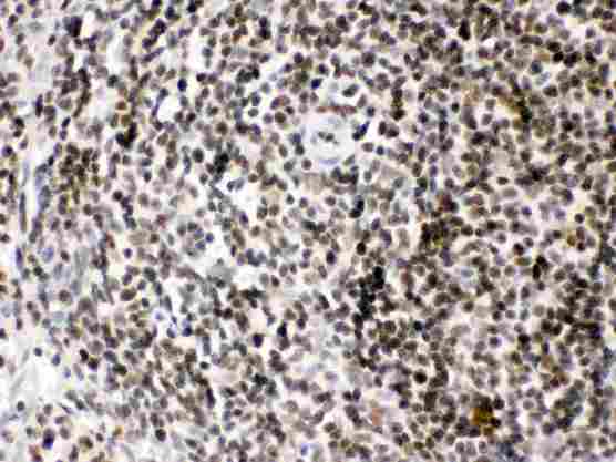 HMG2 / HMGB2 Antibody - HMGB2 was detected in paraffin-embedded sections of rat spleen tissues using rabbit anti- HMGB2 Antigen Affinity purified polyclonal antibody