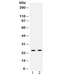HMG2 / HMGB2 Antibody - Western blot testing of 1) rat liver and 2) human placenta lysate with HMGB2 antibody at 0.5ug/ml. Expected molecular weight ~24 kDa.