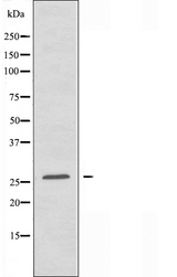 HMG2 / HMGB2 Antibody - Western blot analysis of extracts of COLO205 cells using HMGB2 antibody.