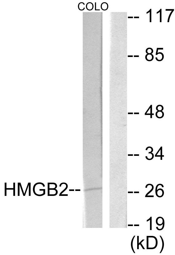 HMG2 / HMGB2 Antibody - Western blot analysis of extracts from COLO205 cells, using HMGB2 antibody.