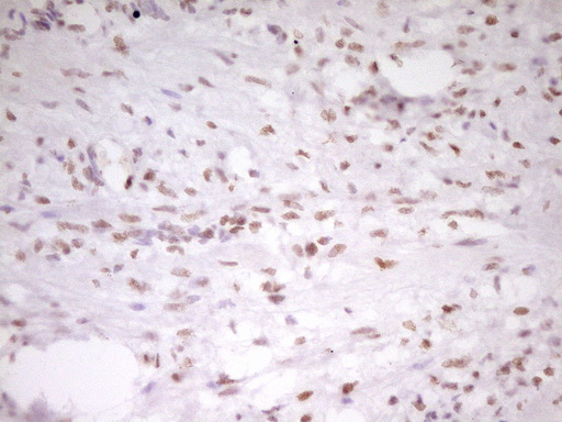 HMG20A Antibody - Immunohistochemical staining of paraffin-embedded Human Ovary tissue within the normal limits using anti-HMG20A mouse monoclonal antibody. (Heat-induced epitope retrieval by 1 mM EDTA in 10mM Tris, pH8.5, 120C for 3min,