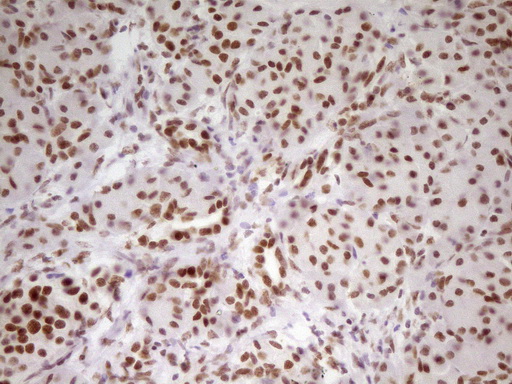 HMG20A Antibody - Immunohistochemical staining of paraffin-embedded Human pancreas tissue within the normal limits using anti-HMG20A mouse monoclonal antibody. (Heat-induced epitope retrieval by 1 mM EDTA in 10mM Tris, pH8.5, 120C for 3min,