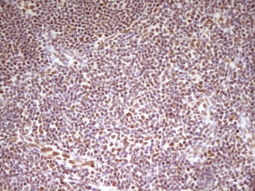 HMG20A Antibody - Immunohistochemical staining of paraffin-embedded Human lymph node tissue within the normal limits using anti-HMG20A mouse monoclonal antibody. (Heat-induced epitope retrieval by 1 mM EDTA in 10mM Tris, pH8.5, 120C for 3min,