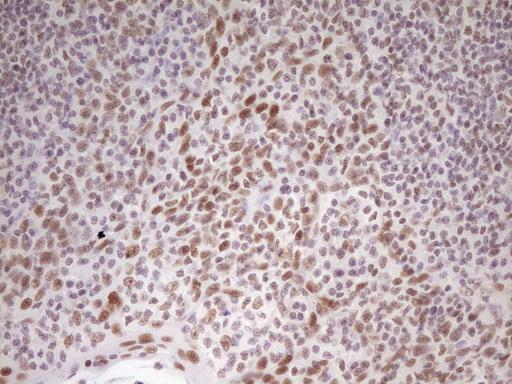 HMG20A Antibody - Immunohistochemical staining of paraffin-embedded Human tonsil within the normal limits using anti-HMG20A mouse monoclonal antibody. (Heat-induced epitope retrieval by 1 mM EDTA in 10mM Tris, pH8.5, 120C for 3min,