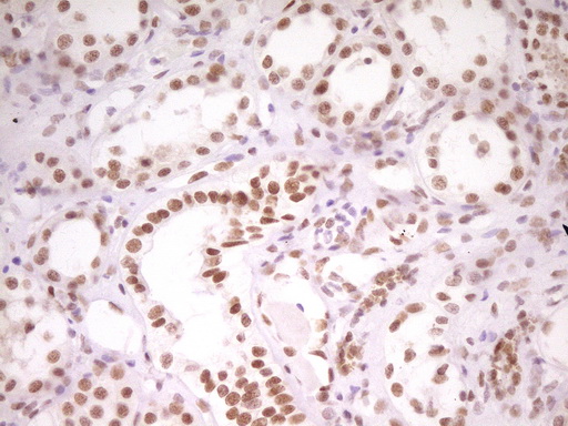 HMG20A Antibody - Immunohistochemical staining of paraffin-embedded Human Kidney tissue within the normal limits using anti-HMG20A mouse monoclonal antibody. (Heat-induced epitope retrieval by 1 mM EDTA in 10mM Tris, pH8.5, 120C for 3min,