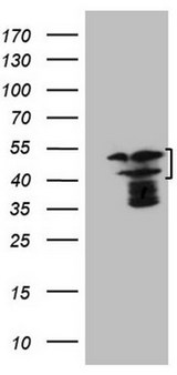 HMG20A Antibody - HEK293T cells were transfected with the pCMV6-ENTRY control (Left lane) or pCMV6-ENTRY HMG20A (Right lane) cDNA for 48 hrs and lysed. Equivalent amounts of cell lysates (5 ug per lane) were separated by SDS-PAGE and immunoblotted with anti-HMG20A.