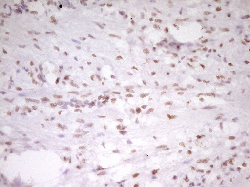 HMG20A Antibody - IHC of paraffin-embedded Human Ovary tissue using anti-HMG20A mouse monoclonal antibody. (Heat-induced epitope retrieval by 1 mM EDTA in 10mM Tris, pH8.5, 120°C for 3min).