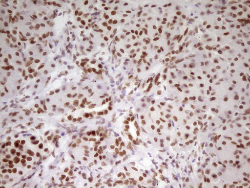 HMG20A Antibody - IHC of paraffin-embedded Human pancreas tissue using anti-HMG20A mouse monoclonal antibody. (Heat-induced epitope retrieval by 1 mM EDTA in 10mM Tris, pH8.5, 120°C for 3min).