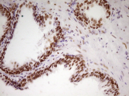 HMG20A Antibody - IHC of paraffin-embedded Human prostate tissue using anti-HMG20A mouse monoclonal antibody. (Heat-induced epitope retrieval by 1 mM EDTA in 10mM Tris, pH8.5, 120°C for 3min).