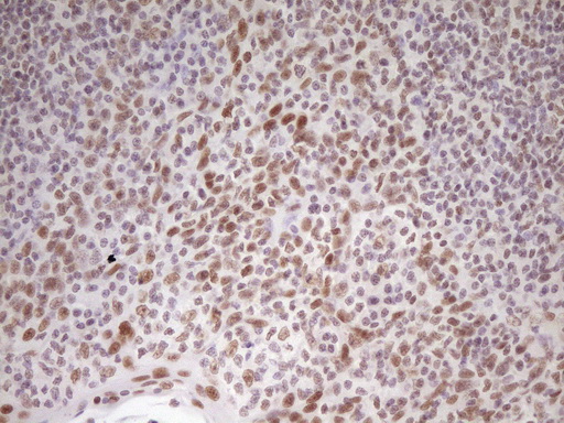 HMG20A Antibody - IHC of paraffin-embedded Human tonsil using anti-HMG20A mouse monoclonal antibody. (Heat-induced epitope retrieval by 1 mM EDTA in 10mM Tris, pH8.5, 120°C for 3min).