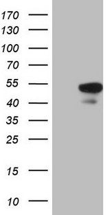 HMG20A Antibody - HEK293T cells were transfected with the pCMV6-ENTRY control. (Left lane) or pCMV6-ENTRY HMG20A. (Right lane) cDNA for 48 hrs and lysed. Equivalent amounts of cell lysates. (5 ug per lane) were separated by SDS-PAGE and immunoblotted with anti-HMG20A.