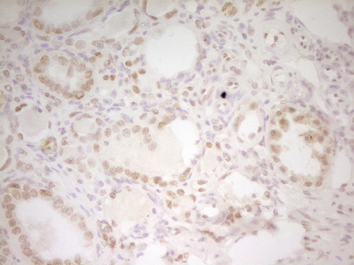 HMG20A Antibody - Immunohistochemical staining of paraffin-embedded Human Kidney tissue within the normal limits using anti-HMG20A mouse monoclonal antibody. (Heat-induced epitope retrieval by 1 mM EDTA in 10mM Tris, pH8.5, 120C for 3min,