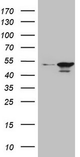 HMG20A Antibody - HEK293T cells were transfected with the pCMV6-ENTRY control. (Left lane) or pCMV6-ENTRY HMG20A. (Right lane) cDNA for 48 hrs and lysed. Equivalent amounts of cell lysates. (5 ug per lane) were separated by SDS-PAGE and immunoblotted with anti-HMG20A.