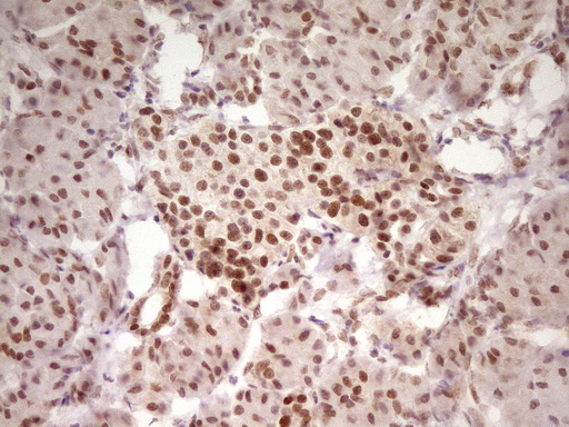 HMG20A Antibody - Immunohistochemical staining of paraffin-embedded Human pancreas tissue within the normal limits using anti-HMG20A mouse monoclonal antibody. (Heat-induced epitope retrieval by 1 mM EDTA in 10mM Tris, pH8.5, 120C for 3min,