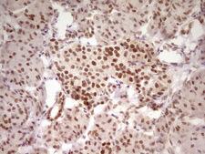 HMG20A Antibody - Immunohistochemical staining of paraffin-embedded Human pancreas tissue within the normal limits using anti-HMG20A mouse monoclonal antibody. (Heat-induced epitope retrieval by 1 mM EDTA in 10mM Tris, pH8.5, 120C for 3min,