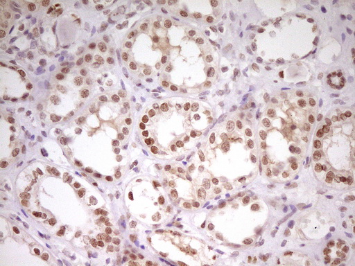 HMG20A Antibody - Immunohistochemical staining of paraffin-embedded Human Kidney tissue within the normal limits using anti-HMG20A mouse monoclonal antibody. (Heat-induced epitope retrieval by 1 mM EDTA in 10mM Tris, pH8.5, 120C for 3min,