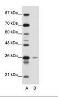 HMG20A Antibody - A: Marker, B: Jurkat Cell Lysate.  This image was taken for the unconjugated form of this product. Other forms have not been tested.