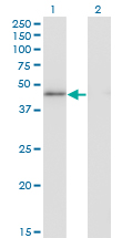 HMG20A Antibody - Western blot of HMG20A expression in transfected 293T cell line by HMG20A monoclonal antibody (M01), clone 4D5.