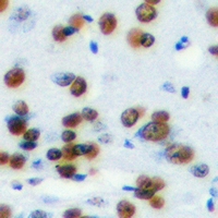 HMG20A Antibody - Immunohistochemical analysis of HMG-20A staining in mouse brain formalin fixed paraffin embedded tissue section. The section was pre-treated using heat mediated antigen retrieval with sodium citrate buffer (pH 6.0). The section was then incubated with the antibody at room temperature and detected using an HRP conjugated compact polymer system. DAB was used as the chromogen. The section was then counterstained with hematoxylin and mounted with DPX.