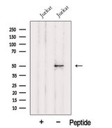 HMG20A Antibody - Western blot analysis of extracts of Jurkat cells using HMG20A antibody. The lane on the left was treated with blocking peptide.