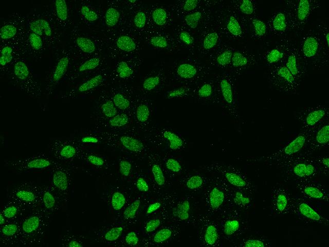 HMG20A Antibody - Immunofluorescence staining of HMG20A in U2OS cells. Cells were fixed with 4% PFA, permeabilzed with 0.1% Triton X-100 in PBS, blocked with 10% serum, and incubated with rabbit anti-Human HMG20A polyclonal antibody (dilution ratio 1:200) at 4°C overnight. Then cells were stained with the Alexa Fluor 488-conjugated Goat Anti-rabbit IgG secondary antibody (green). Positive staining was localized to Nucleus.