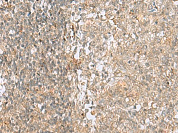 HMG20A Antibody - Immunohistochemistry of paraffin-embedded Human tonsil tissue  using HMG20A Polyclonal Antibody at dilution of 1:25(×200)