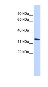 HMG20A Antibody - HMG20A antibody Western blot of 293T cell lysate. This image was taken for the unconjugated form of this product. Other forms have not been tested.