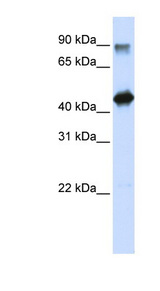 HMG20A Antibody - HMG20A antibody Western blot of Transfected 293T cell lysate. This image was taken for the unconjugated form of this product. Other forms have not been tested.