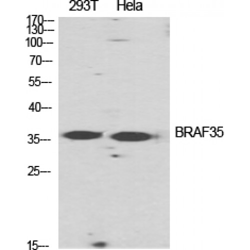 HMG20B / BRAF35 Antibody - Western blot of BRAF35 antibody
