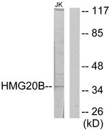 HMG20B / BRAF35 Antibody - Western blot analysis of lysates from Jurkat cells, using HMG20B Antibody. The lane on the right is blocked with the synthesized peptide.