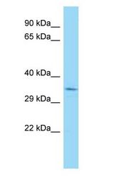 HMG20B / BRAF35 Antibody - HMG20B / BRAF35 antibody Western Blot of Rat Muscle.  This image was taken for the unconjugated form of this product. Other forms have not been tested.