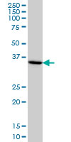 HMG20B / BRAF35 Antibody - HMG20B monoclonal antibody (M01), clone IF6 Western blot of HMG20B expression in HeLa.