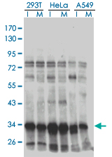 HMG20B / BRAF35 Antibody - Western blot of HMG20B in extracts from 293T, HeLa and A549 cell using anti-HMG20B monoclonal antibody.